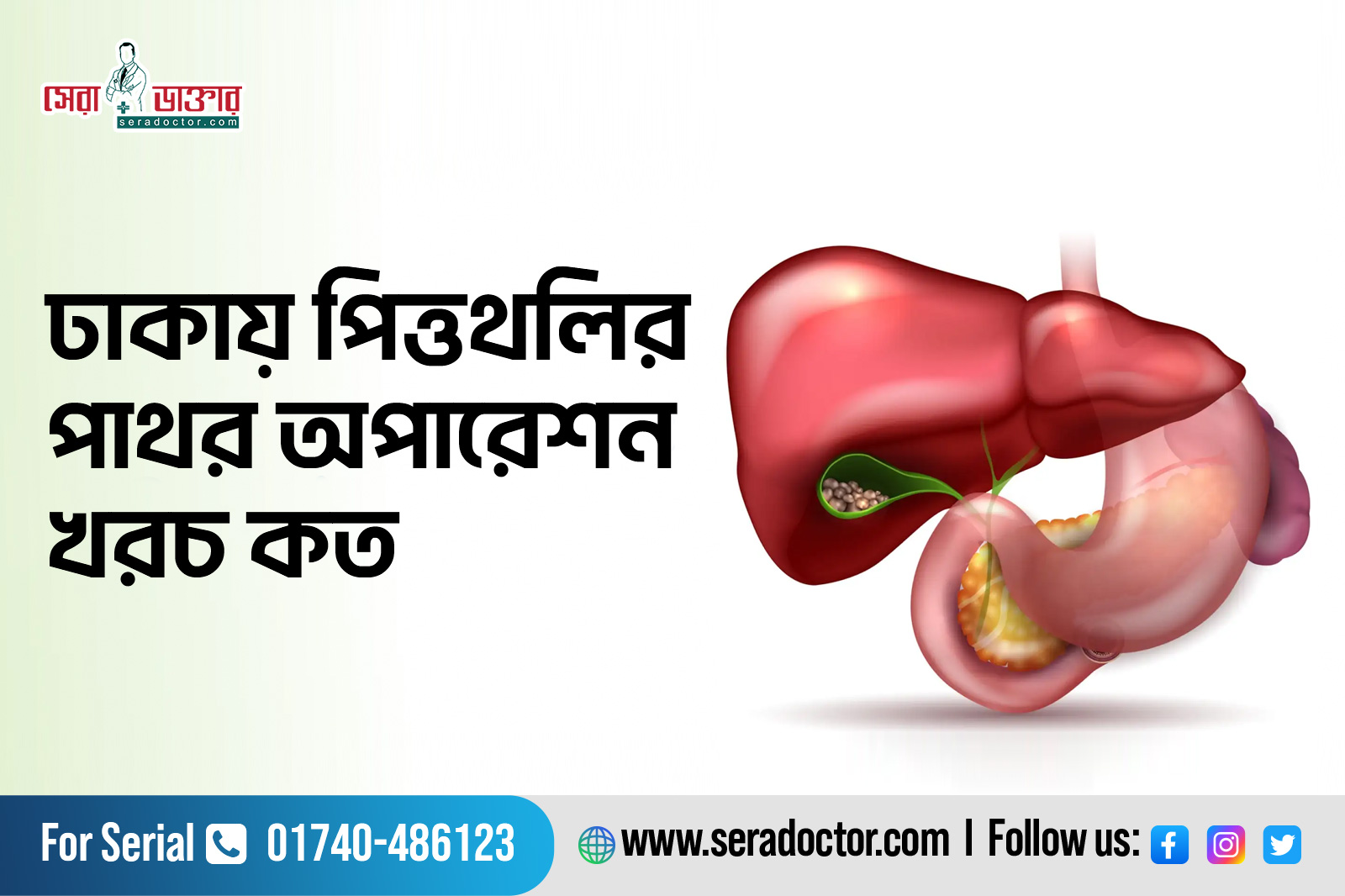 পিত্তথলির পাথর অপারেশন খরচ কত